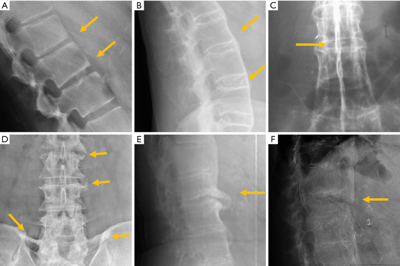 Figure 25