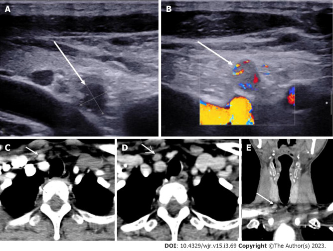 Figure 10