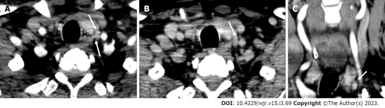 Figure 13