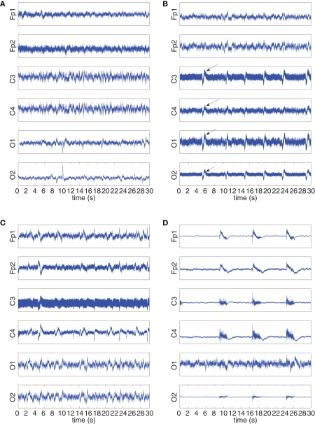 Figure 13