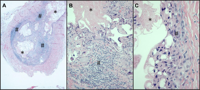 Fig 2