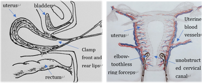 Fig. 2