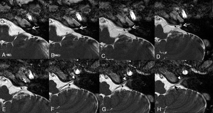 Fig 3.