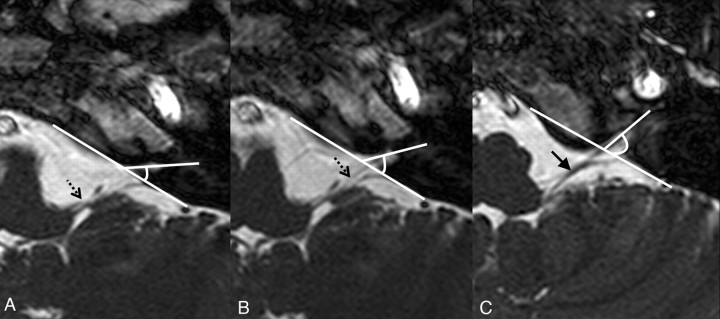 Fig 2.