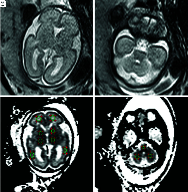 FIG 1.