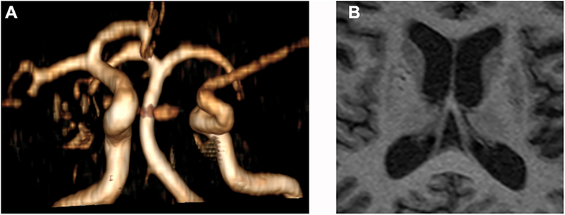 Figure 1: