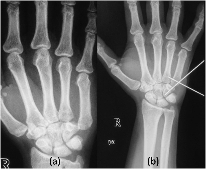 Fig. 6