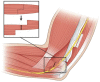 Figure 11.
