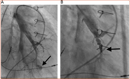 Figure 4: