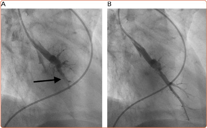 Figure 3: