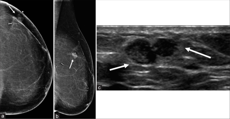 Figure 1: