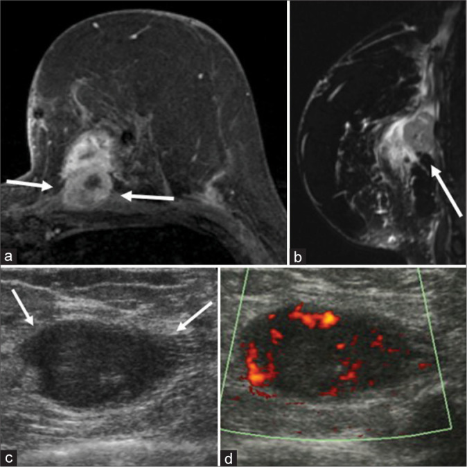 Figure 2: