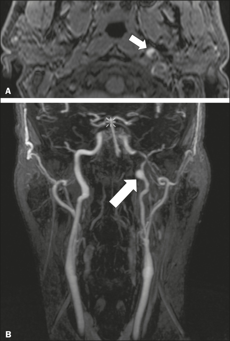 Figure 11