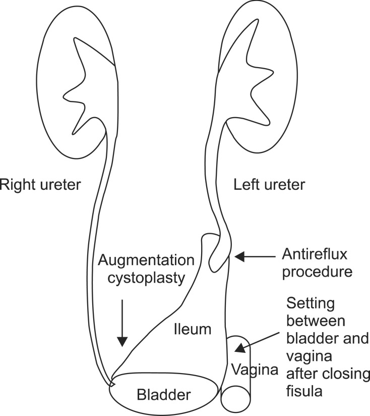 FIG. 1