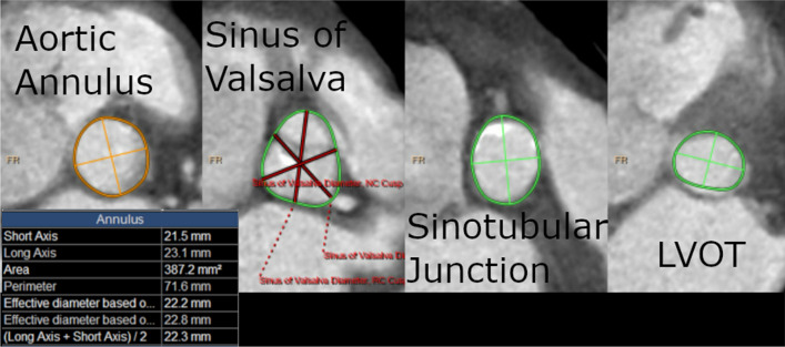 Fig. 2
