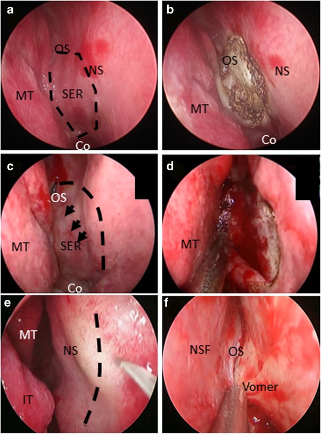 Fig. 4