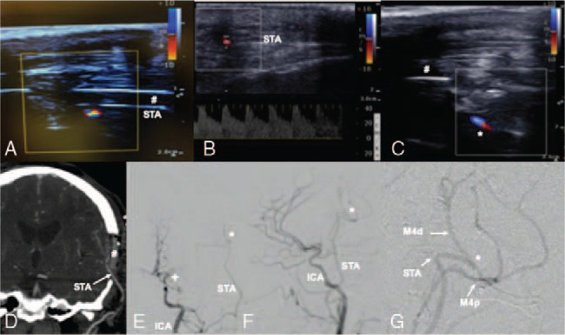 FIGURE 3