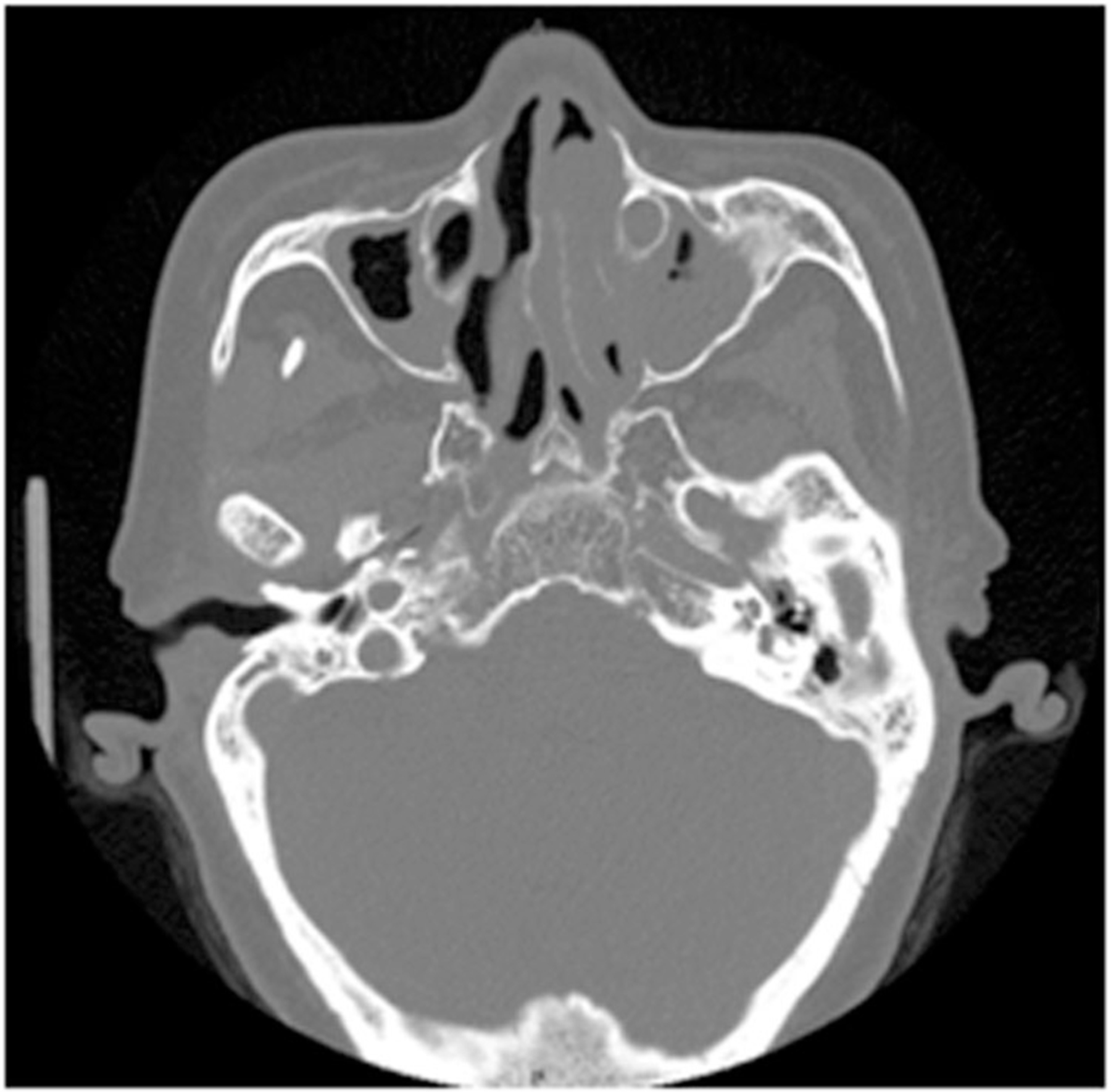 FIGURE 3