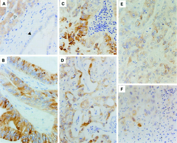 Figure 2  