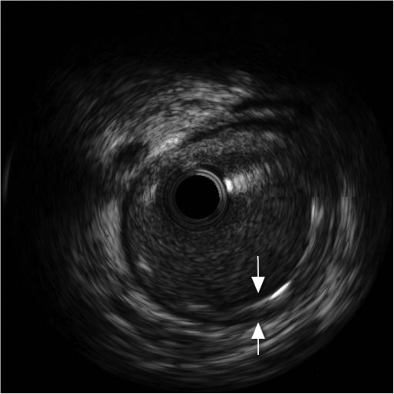 Figure 10