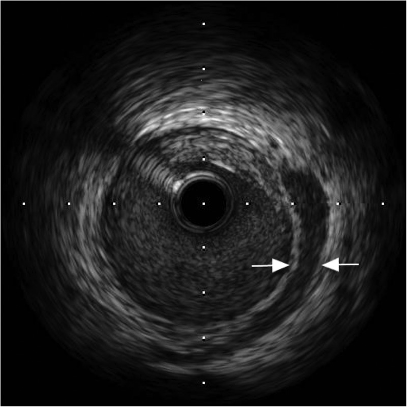 Figure 5