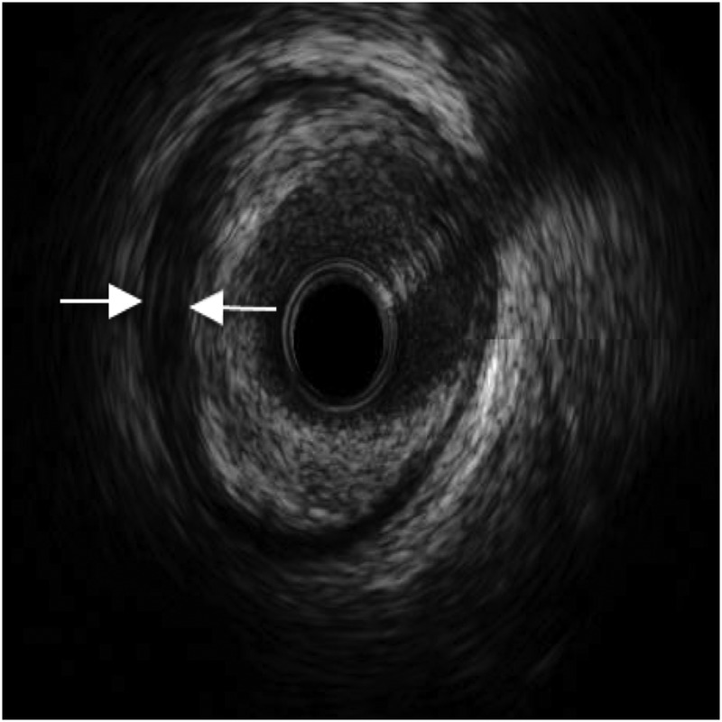 Figure 2