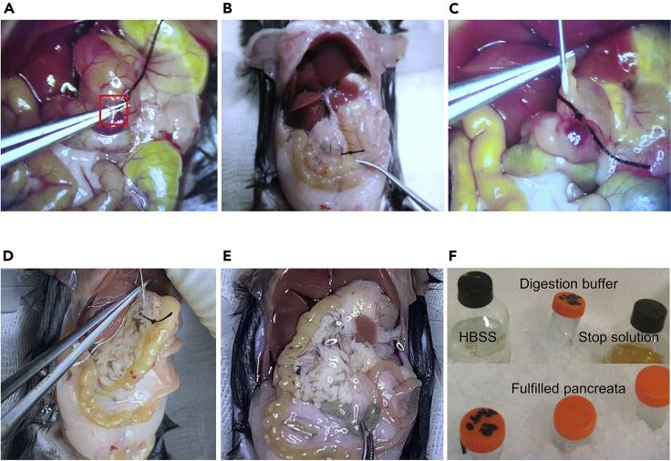 Figure 4