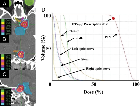 Fig. 2.