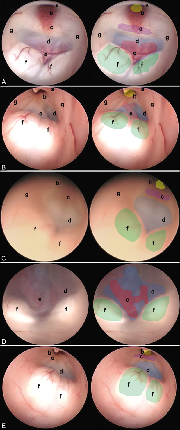 Figure 3: