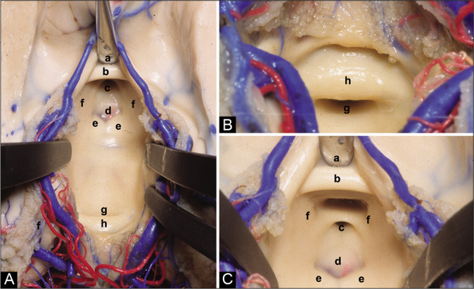 Figure 2: