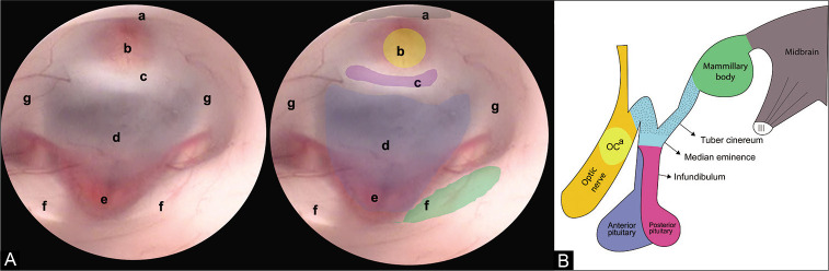 Figure 1: