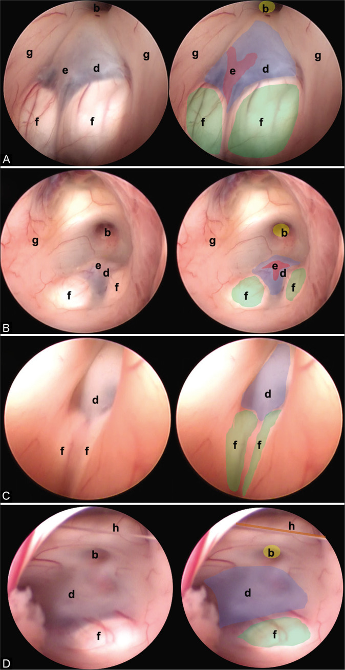 Figure 4: