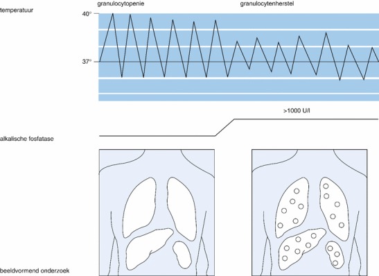 graphic file with name 978-90-368-1117-0_17_Fig4_HTML.jpg