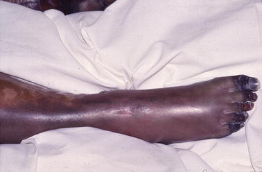 graphic file with name 978-90-368-1117-0_17_Fig9_HTML.jpg