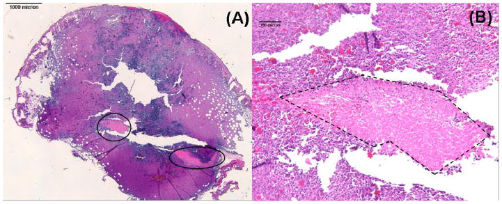 Fig. 11