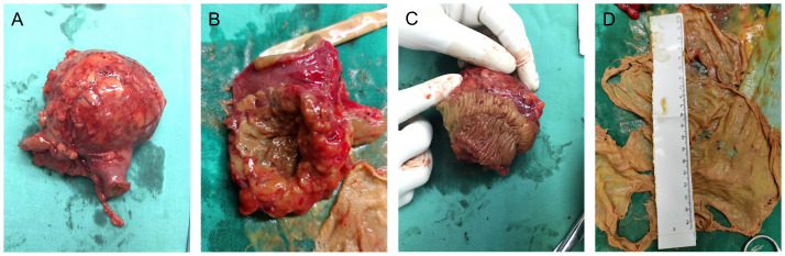 Figure 2