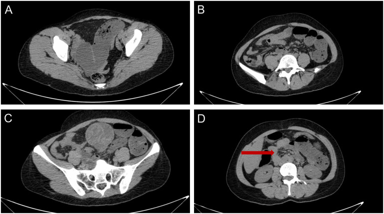 Figure 1