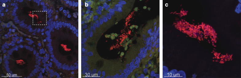 Fig. 1