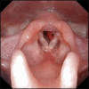 Fig. 11