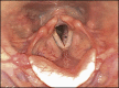 Fig. 12