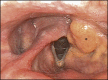 Fig. 17