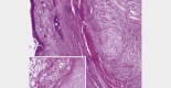 Fig. 15