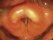 Fig. 19