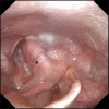 Fig. 14