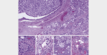 Fig. 13