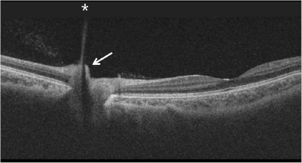 Fig. 3