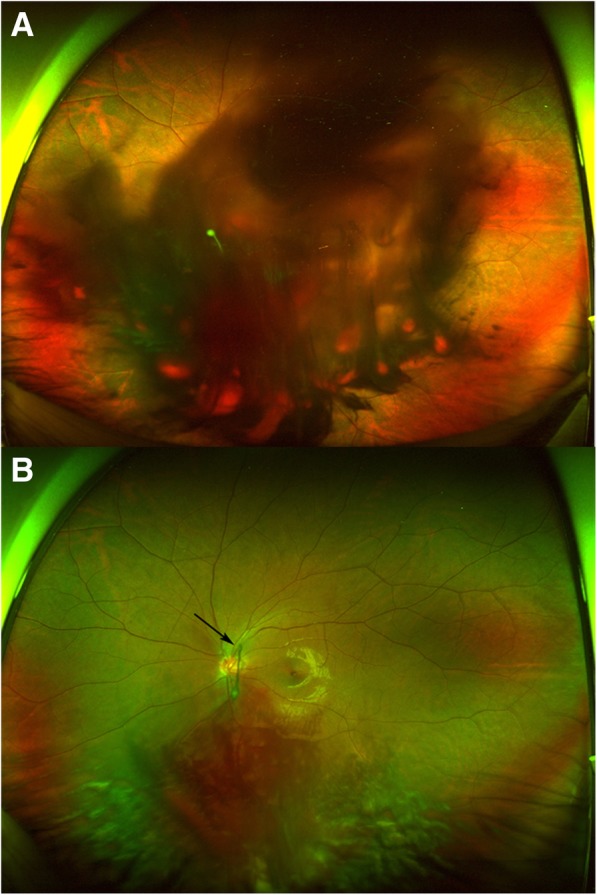 Fig. 1