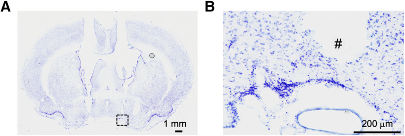 Figure 11.