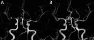Fig. 9