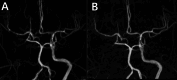 Fig. 11